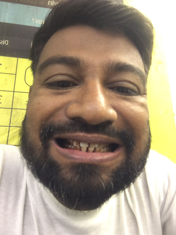 After using Dr. Dental