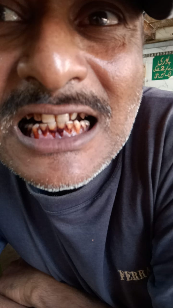 Before using Dr. Dental