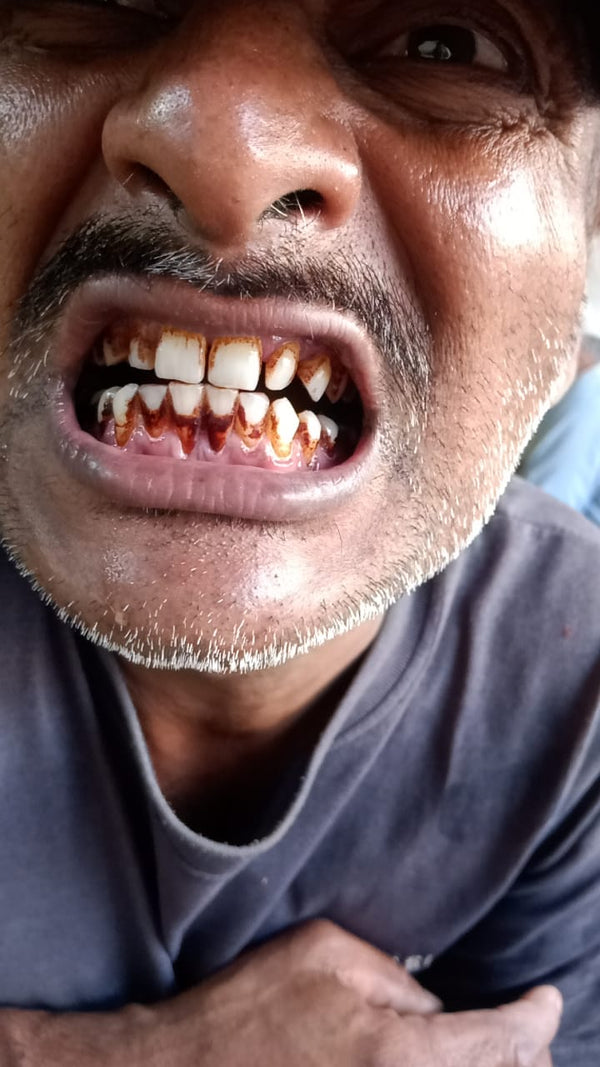 After using Dr. Dental