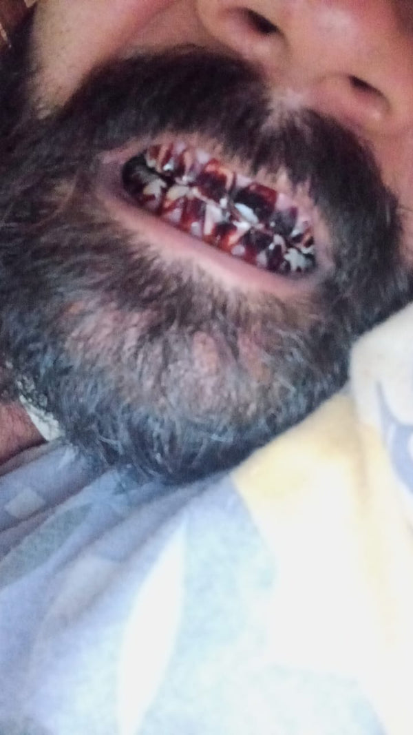 Before using Dr. Dental