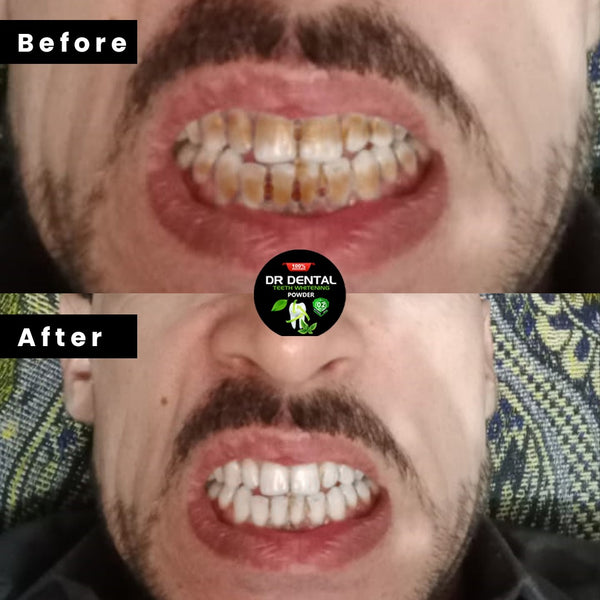 Before using Dr. Dental