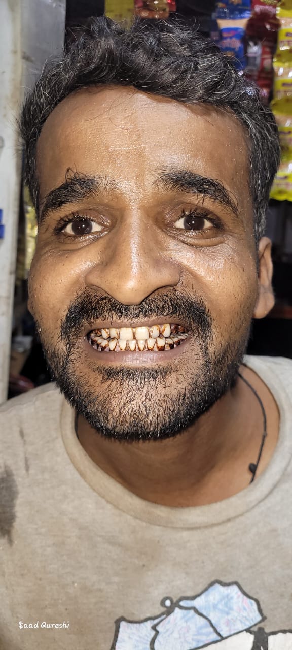 After using Dr. Dental