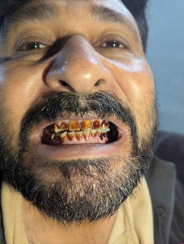 Before using Dr. Dental