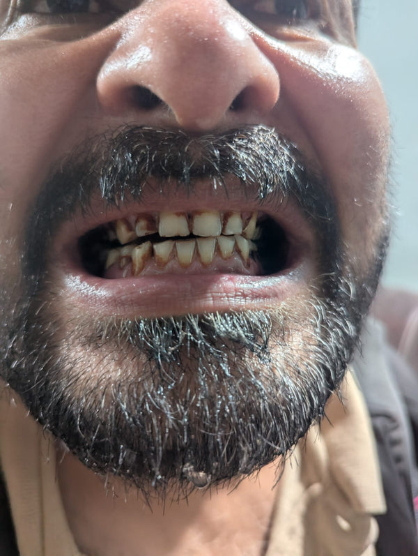 After using Dr. Dental